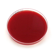 Fastidious anaerobe agar (FAA) herkkyysmalja hevosenverellä			